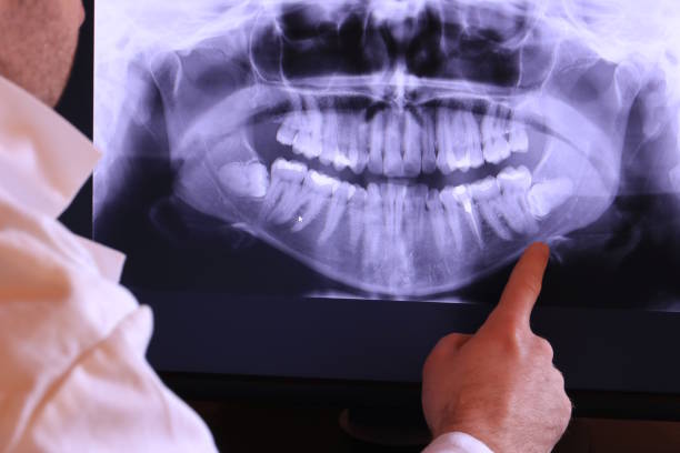 Best Emergency Treatment for Oral Infections in Vero Beach, FL